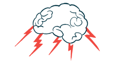 Lightning bolts are seen shooting out of a human brain in this illustration.